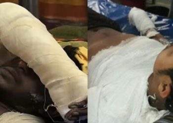 সোনারগাঁয়ে স্টিল মিলে ১৩ দগ্ধ শ্রমিকের মধ্যে ২ জনের মৃত্যু