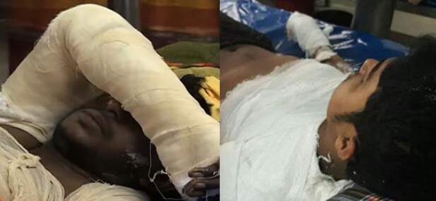 সোনারগাঁয়ে স্টিল মিলে ১৩ দগ্ধ শ্রমিকের মধ্যে ২ জনের মৃত্যু