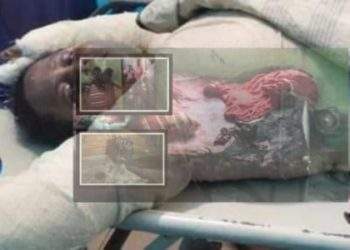 না.গঞ্জে গ্যাসের বিস্ফোরণে দগ্ধ স্বামীর মৃত্যু, স্ত্রী রোজিনা ঝুঁকিপূর্ণ