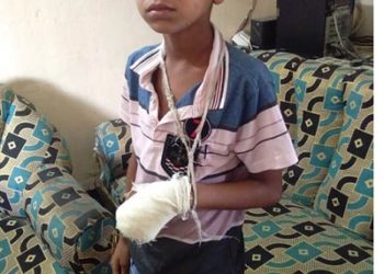 আড়াইহাজারে শিশুর আঙ্গুল কেটে ফেলার অভিযোগ