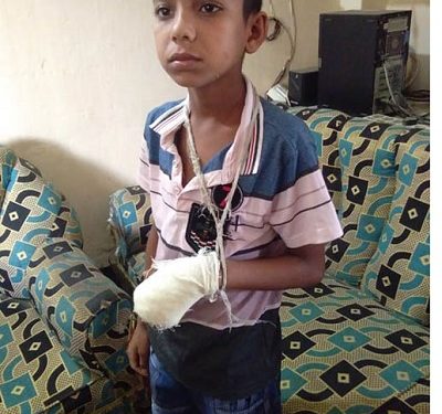 আড়াইহাজারে শিশুর আঙ্গুল কেটে ফেলার অভিযোগ