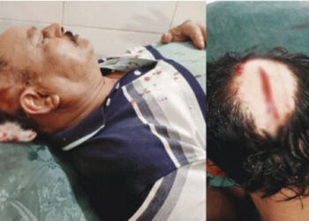 সাবেক চেয়ারম্যান ও তার পুত্রসহ কয়েকজনকে কুপিয়ে জখম