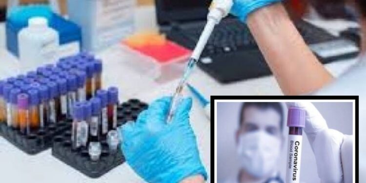 আমদানির ‘ভুলে’ নারায়ণগঞ্জেও কিট সংকট