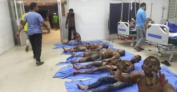 বিস্ফোরণে ৩৭ মুসল্লি বার্ন ইউনিটে, দগ্ধরা আশংকায়