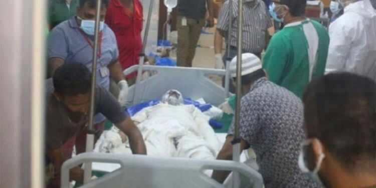 দগ্ধ ৫ জনের অবস্থা উন্নতির দিকে, তবে শঙ্কামুক্ত নন