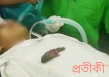 আড়াইহাজারে গলায় কই মাছ আটকে স্কুল ছাত্রের মৃত্যু