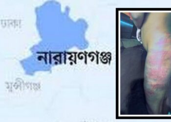 মাদ্রাসা শিক্ষার্থীকে রড দিয়ে মারধরের ঘটনায় তিন শিক্ষকের বিরুদ্ধে মামলা