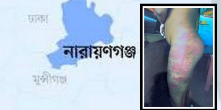 মাদ্রাসা শিক্ষার্থীকে রড দিয়ে মারধরের ঘটনায় তিন শিক্ষকের বিরুদ্ধে মামলা