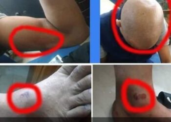 ব্যাংক কর্মকর্তাকে নিরাময় কেন্দ্রে নির্যাতন : গ্রেফতার ১