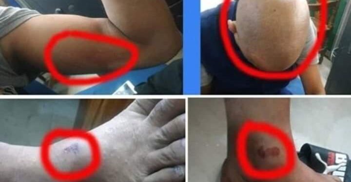 ব্যাংক কর্মকর্তাকে নিরাময় কেন্দ্রে নির্যাতন : গ্রেফতার ১