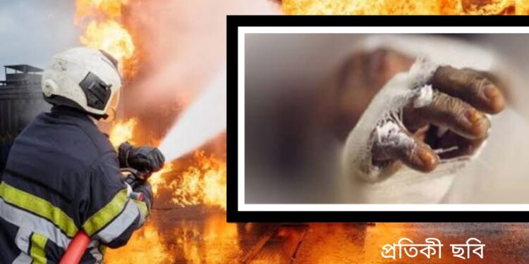 সোনারগাঁয়ে প্রিন্টিং কারখানায় গ্যাসের আগুনে দগ্ধ ৫ শ্রমিক