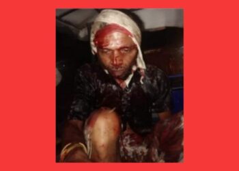 ফতুল্লায় ইজিবাইক চালককে কুপিয়ে রক্তাক্ত