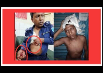 আড়াইহাজারে ডাকাত পুলিশ-গুলাগুলি, আহত ৬