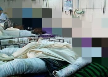 জাম্বুরা পাড়তে গিয়ে বিদ্যুতে পুড়লেন পোশাক শ্রমিক