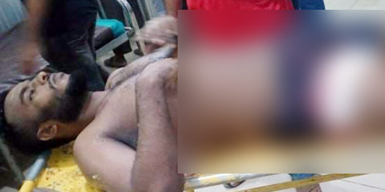 সিদ্ধিরগঞ্জে চুরির ভাগবাটোয়ারার দ্বন্ধে গুলিবিদ্ধ যুবক