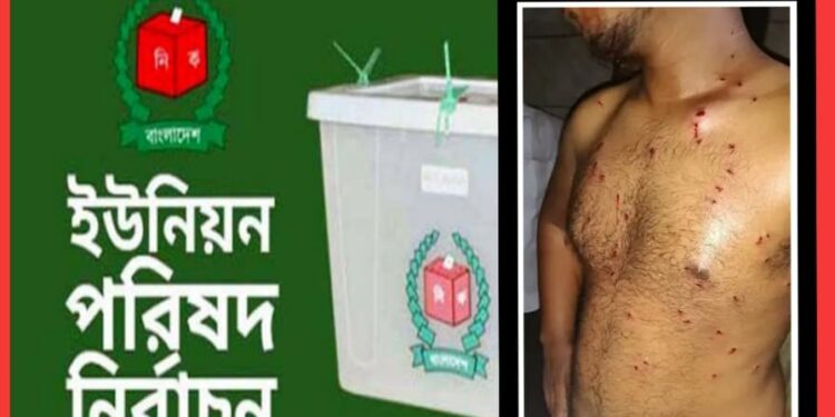 বন্দরের নির্বাচন : পুলিশের সঙ্গে সংঘর্ষে আহত ১০