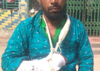 আড়াইহাজারে আঙ্গুল বিচ্ছিন্ন, উল্টো মামলা