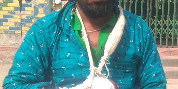 আড়াইহাজারে আঙ্গুল বিচ্ছিন্ন, উল্টো মামলা