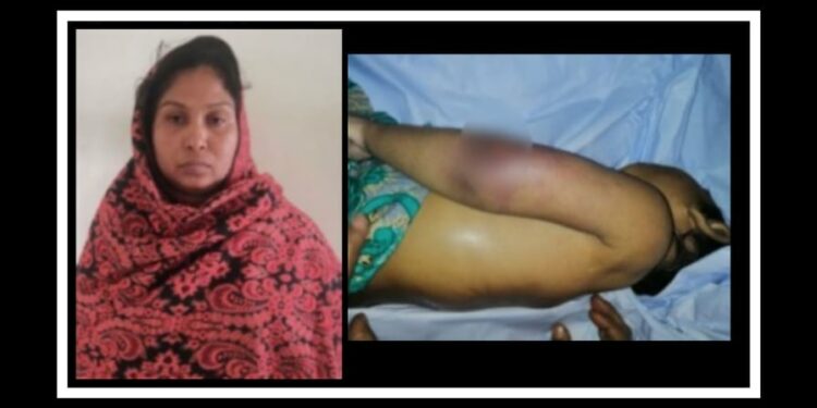 সৎ মায়ের কান্ড, নির্যাতনে শিশুর মৃত্যু