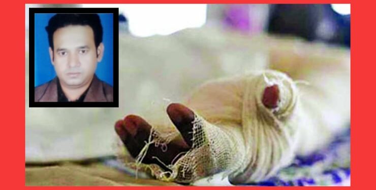 ফতুল্লায় এসিডে পোড়া যুবকের ঝুলন্ত লাশ উদ্ধার