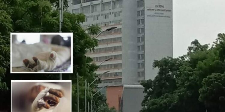 ফতুল্লায় অগ্নিদগ্ধ স্বামীর মৃত্যু, স্ত্রী আশঙ্কায়