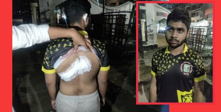 নগরীতে সাংবাদিকপুত্র ছুরিকাহত