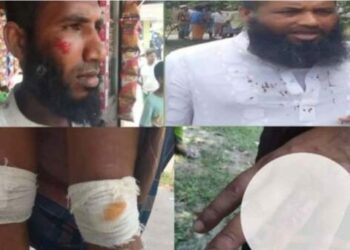 ইস্যূ তুচ্ছ ঘটনা : নেপথ্যে আধিপত্য বিস্তার ! সংঘর্ষে আহত ২০