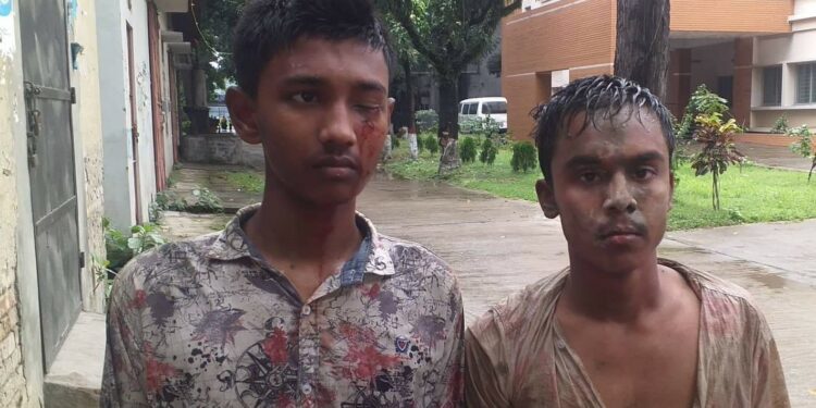 বন্দরে মেরিন টেকনোলজিতে আহত ৩ ছাত্র