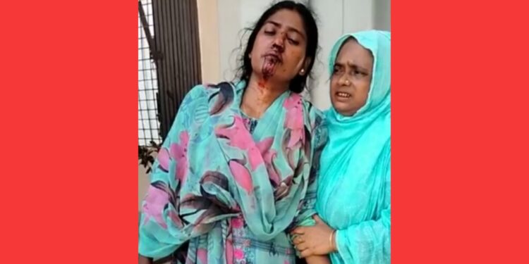 আড়াইহাজারে স্কুল শিক্ষিকাকে পিটিয়ে জখম