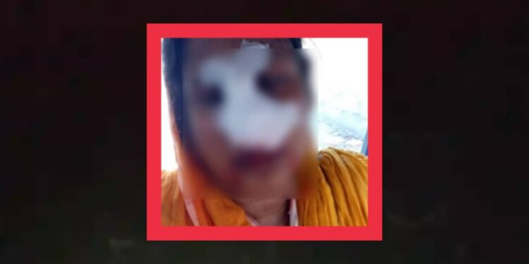 জমি বিরোধের কারণে সিদ্ধিরগঞ্জে বিধবাকে হত্যাচেষ্টা