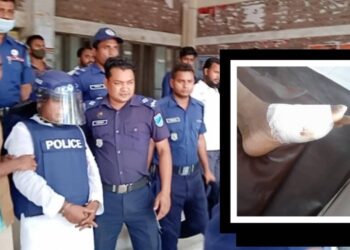 পচন’ ধরেছে নূর হোসেনের