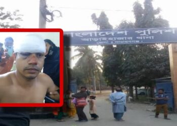 জিডি করায় : চোখ ও হাত-পা খোঁয়ালেন এবাদুর