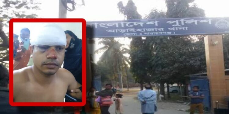 জিডি করায় : চোখ ও হাত-পা খোঁয়ালেন এবাদুর