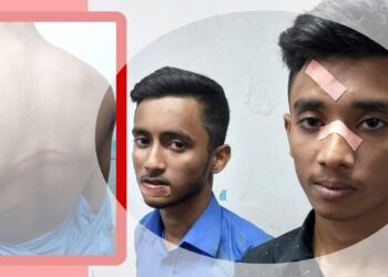 ইভটিজিংয়ের প্রতিবাদ করায় দুই ছাত্র অপহরণ, মারধর