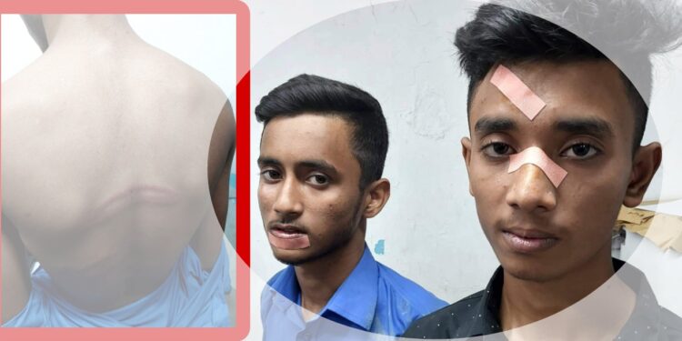 ইভটিজিংয়ের প্রতিবাদ করায় দুই ছাত্র অপহরণ, মারধর