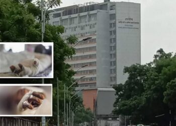 রূপগঞ্জে গ্যাস বিস্ফোরণে এক পরিবারের চারজন দগ্ধ