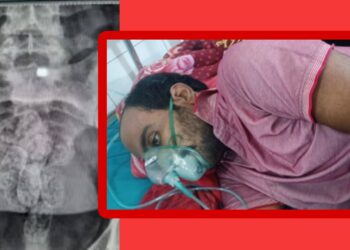 পেটের ভিতর ইয়াবা পাচার ! অতঃপর……..