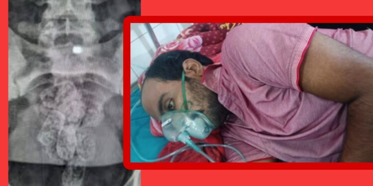 পেটের ভিতর ইয়াবা পাচার ! অতঃপর……..