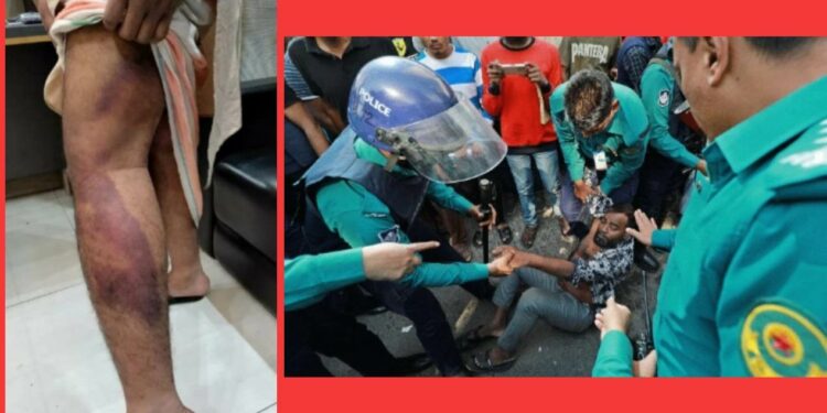 ‘ওসি স্যারের সঙ্গে আর বেয়াদবি করবি ?’