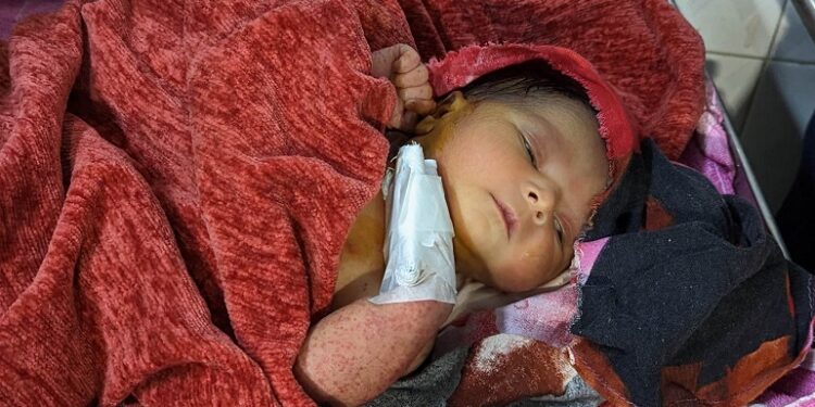 রূপগঞ্জে ময়লার ভাগাড়ে কাফনের কাপড়ে নবজাতক !