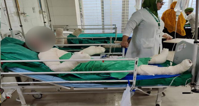 ফতুল্লায় চার্জার ফ্যান বিস্ফোরণ : বাবা-মায়ের পর মেয়ের মৃত্যু