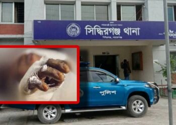 টিভি বিস্ফোরণ : মৃত্যুর কোলে নজরুল, স্ত্রী-কন্যা চিকিৎসাধীন