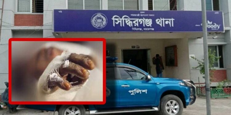 টিভি বিস্ফোরণ : মৃত্যুর কোলে নজরুল, স্ত্রী-কন্যা চিকিৎসাধীন