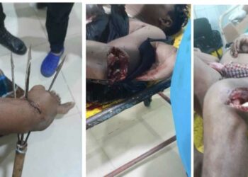 আড়াইহাজারে চামড়া ব্যবসায়ীদের কুপিয়ে জখম