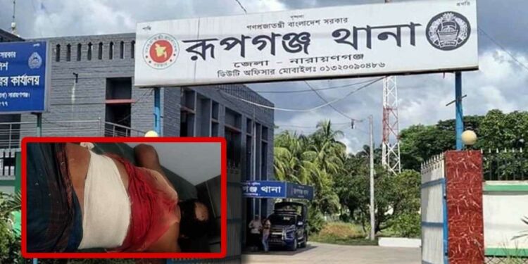 রূপগঞ্জে বিএনপির দুই নেতাকে কুপিয়ে জখম