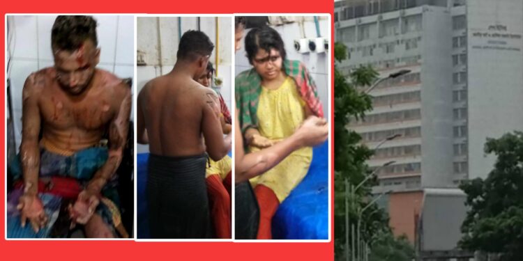 সেই আসলামের বাড়িতে রহস্যজনক বিস্ফোরণ, দগ্ধ ৬