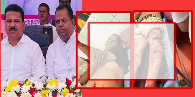 আড়াইহাজারে সাবেক ছাত্রলীগ নেতাকে কুপিয়ে হত্যার চেষ্টা