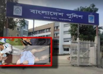 চুরি করতে গিয়ে অগ্নিদগ্ধ, আশংকায় চোর হুমায়ুন