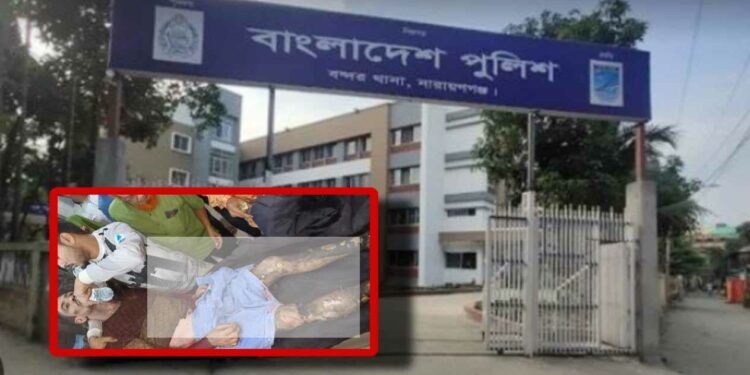 চুরি করতে গিয়ে অগ্নিদগ্ধ, আশংকায় চোর হুমায়ুন