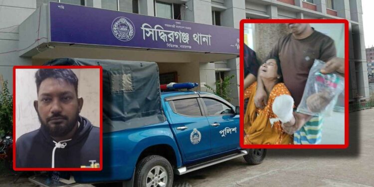 ভাসুরের কান্ড : কব্জি বিচ্ছিন্ন